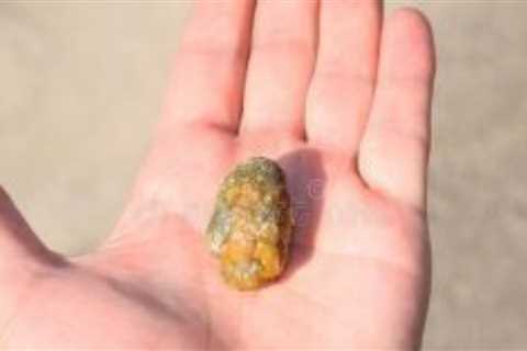 Three Ways to Find Out If You Have Gallstones